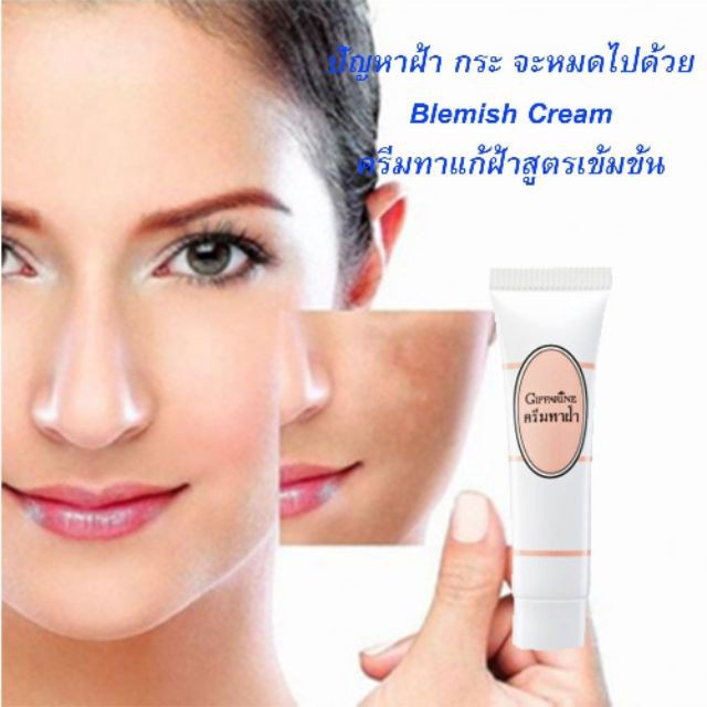 มีโปร กิฟฟารีน ครีมทาฝ้า สูตรเข้มข้น แต้มลดเลือนรอยด่างดำจากฝ้า