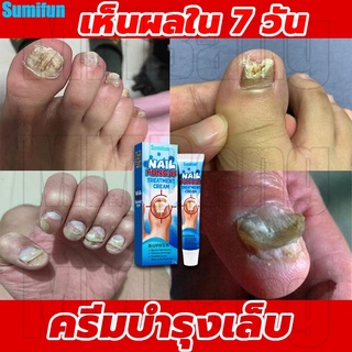 ฆ่าเชื้อราที่เล็บ Sumifun ซรั่มรักษาเล็บ ซ่อมเล็บที่ชำรุด เชื้อราเล็บ ครีมบำรุงเล็บ ยาฆ่าเชื้อราเล็บ น้ำยารักษาเชื้อรา