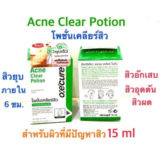 Oxe cure acne clear potion 15 ml. แต้มสิวยุบใน​ 6​ ชม. โลชั่นแต้มสิว ลดสิวอักเสบ สิวอุดตัน สิวผด