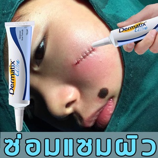 พร้อมส่ง เน้นลบรอยแผลเป็น Dermatix Ultra ครีมซ่อมแซม ครีมทาแผลเป็น แผลเป็น ครีมทาแผลรอยดำ เจลลบรอยแผลเป็น