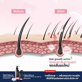 เซรั่มลดผมร่วง Dr.PONG TSUTSUJI HAIR REJUVENATING SERUM - anti-hairloss serum เซรั่มบำรุงผม ลดผมร่วง