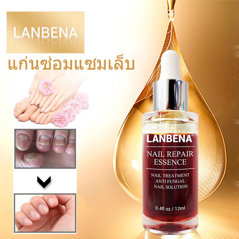 LANBENA Nail Repair Essence Nail Treatment เซรั่มบำรุงเล็บน้ำมัน ...