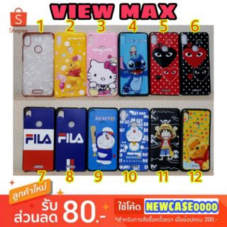 เคส wiko view max / viewmax