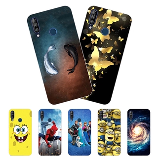 เคสโทรศัพท์มือถือ Tpu สําหรับ Wiko View 3