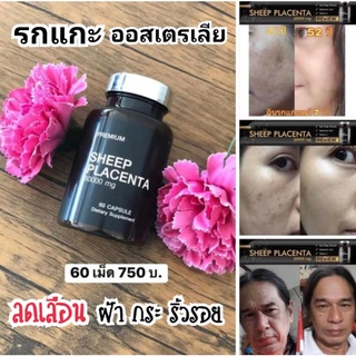 🎯รุ่นใหม่ล่าสุด🎯รกแกะ60000mg นำเข้าจากออสเตรเลีย