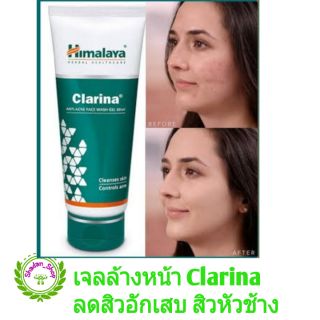 Himalaya Clarina Anti-Acne Face Wash Gel 60 ml เจลล้างหน้าลดสิวอักเสบ สูตรเข้มข้น