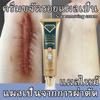 ( ซื้อเยอะลดเยอะ )🔥ครีมลบแผลเป็น ครีมลดรอยแผล ยารักษาแผลเป็น ยาทาแผลเป็นนูน เจลลบรอยแผลเป็น ครีมทาแผลเป็น