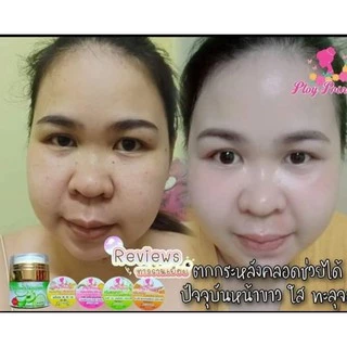 ครีมพลอยปริ้นเซส Ploy Princess ครีมแก้ฝ้า ลดสิว ส่งฟรี