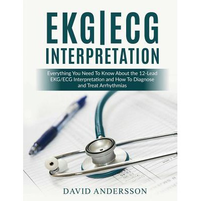 EKG/ECG Interpretation : ทุกอย่างที่คุณต้องรู้เกี่ยวกับการสนทนา ECG/EKG 12-Lead 9781519027122