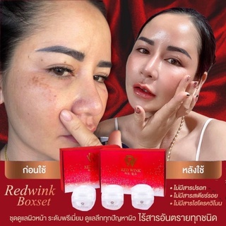 ⚡️ของแท้•ส่งฟรี•ถูกที่สุด⚡️แพ้ยินดีคืนเงิน]Red wink(เรดวิ้ง)ครีมเรดวิ้ง สกินแคร์ ออแกนิก100%•มีบริการเก็บปลายทาง