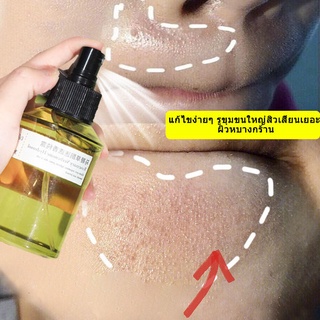 เวอร์บีน่า pore essence สูตรช่วยลดสิวลอกสิวเสี้ยน ช่วยควบคุมความมันกระชับรูขุมขน บอกลาปัญหาสิว เซรั่มบำรุงผิว