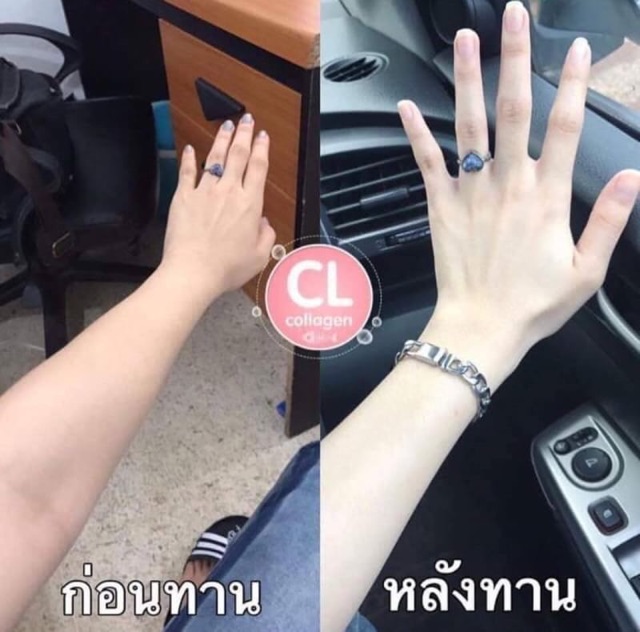 CL Collagen✨ ซีแอล คอลลาเจน