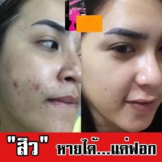 🍊สบู่กลูต้าไวท์ BMK SKINCARE 🍊 ช่วยผลัดเซลล์ผิว เพิ่มความใส✨