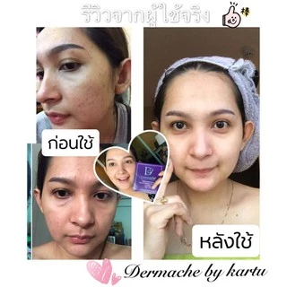 ครีมเดอร์มาเช่ Dermache ของแถมหนักที่สุดในช็อปปี้