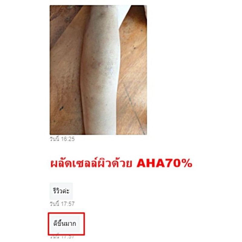AHA70% กรดผลไม้ ทรีทเมนต์ผิว Glycolic acid ราคา ถูกที่สุด ดีลบีเคเค แกลเลอรีภาพที่ 3