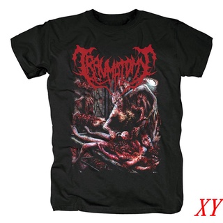 Xy ขายดี เสื้อยืดแขนสั้นลําลอง พิมพ์ลาย Traumatomy Death Metal สําหรับผู้ชาย