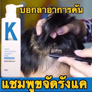 💥แก้อาการคันหนังศรีษะ 1 ขวด💥OUSHLIAN แชมพูขจัดรังแค สำหรับคันหนังศีรษะ แชมพูกําจัดรังแค ยาสระผมขจัดรังแค ยาสระผมรังแค