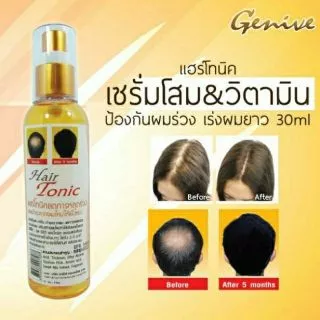 🔥ค่าส่งถูก+แท้🐌 Genive Hair Tonic 120ml มีอย. ลดผมร่วง ปลูกผม ขจัดรังแค แก้คัน จีนิวี แฮร์ โทนิค Spray บำรุงรากผม