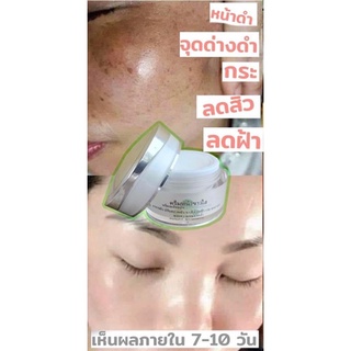 ครีมองุ่นขาว  รักษา ฝ้า สิว ริ้วรอย จุดด่างดำ ผิวหน้าขาวใส