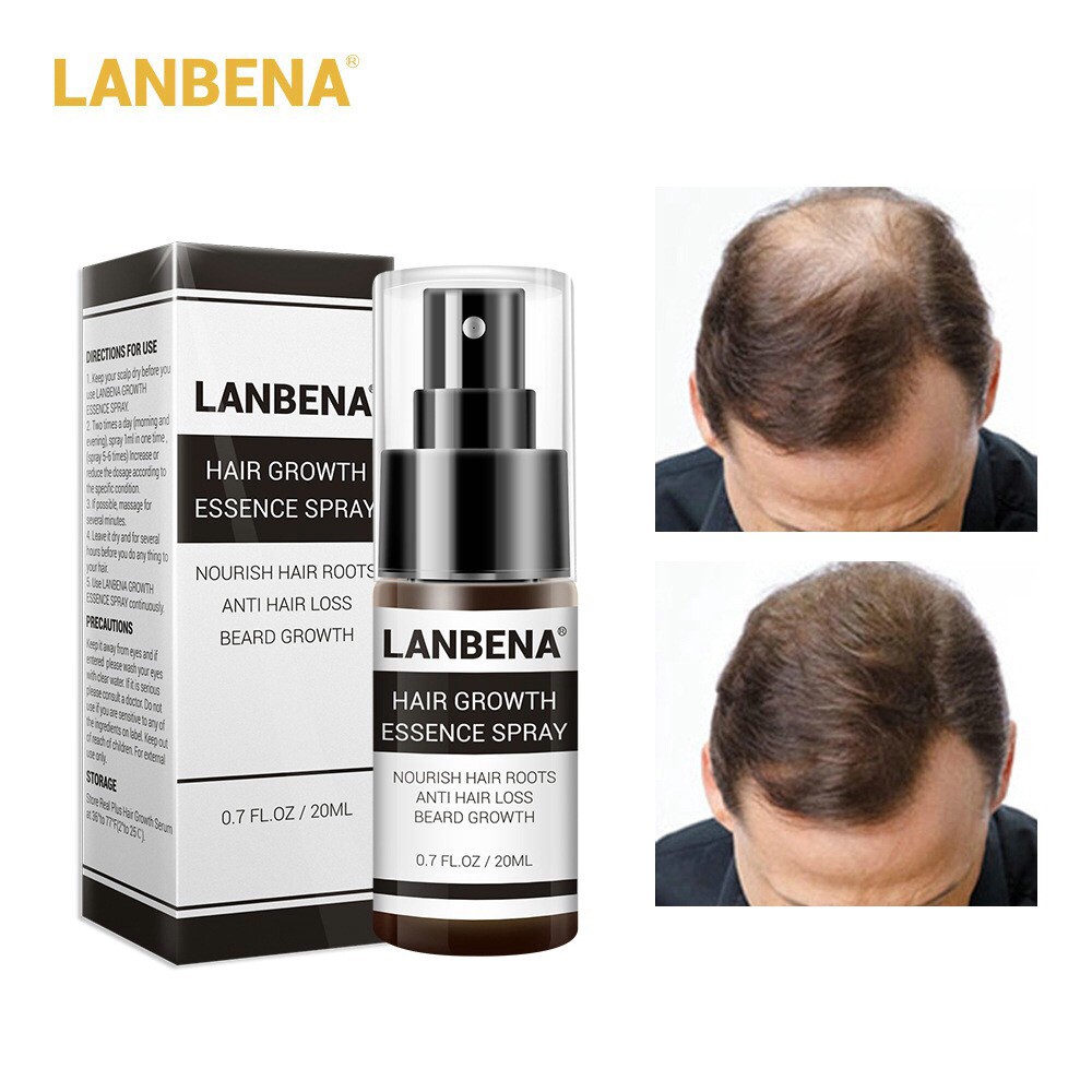 Spayสเปรย์เซรั่ม ลดผมบาง แก้ปัญหาหัวล้าน LANBENA Powerful Hair