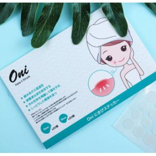 แผ่นซับสิวจากโอนิ Oni Acne Patch 40pcs แปะปุ๊บ ดูดปั๊บ ช่วยดูดซับของเหลวจากสิวภายใต้ผิวหนังให้ผิวสมาน