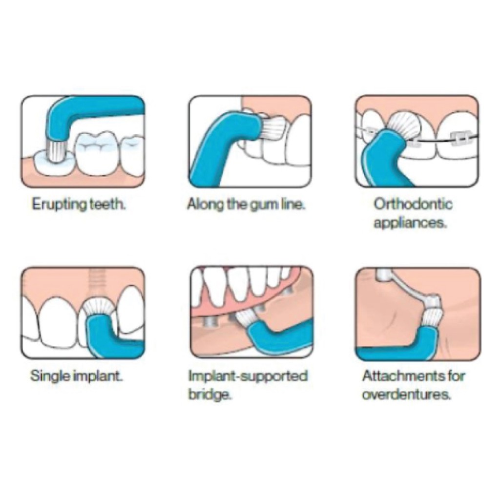 แปรงกระจุกเดียว Gum Butler Single End Tuft Brush newtrend.dental ThaiPick