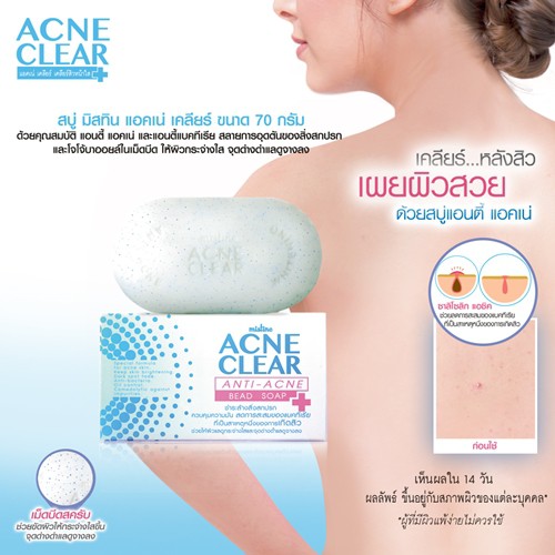 มิสทิน แอคเน่ เคลียร์ แอนตี้ แอคเน่ บีท โซป MISTINE ACNE CLEAR ANTI-ACNE BEAD SOAP