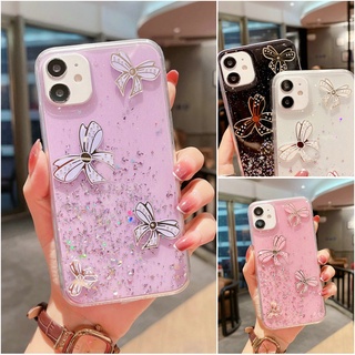 Samsung S20 S21 Plus Ultra 5G J2 J5 J7 Pro 2016 2018 S21+ S21Ultra Bow Candy Glitter Clear Soft Epoxy Phone Back Case