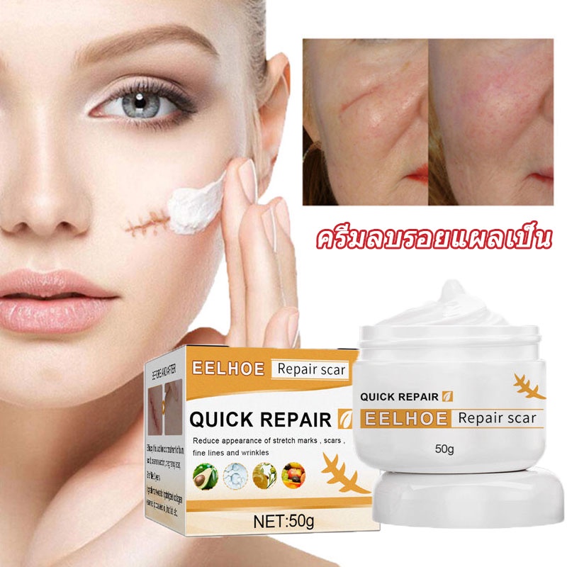 EELHOE ครีมลดรอยแผลเป็น 50ml เร่งการซ่อมแซมให้ผิว ลดรอยแผลเป็น Scar cream ลบรอยแผลเป็นจากต้นเหตุ เหมาะใช้กับรอยสิว รอยแผลผ่าตัดและรอยแผลเป็นต่างๆ(ครีมลบแผลเป็น,ครีมบำรุงหน้า,ยารักษาแผลเป็น,ลบรอยแผลเปน,ยาทาแผลเป็นนูน,เจลลบรอยแผลเป็น,ครีมทาแผลเป็น)