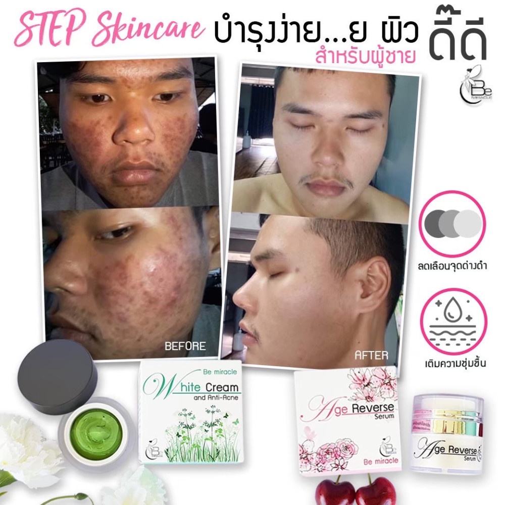 ครีมบีมิราเคิล (Bemiracle cream) ครีมเขียวรักษาสิวทุกชนิด ลดรอยด่างดำ หน้าขาวกระจ่างใส ราคา ถูกที่สุด ดีลบีเคเค แกลเลอรีภาพที่ 4