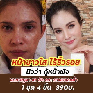 เซตหน้าใส ครีม Newwa (นิววา) ลดสิว ฝ้า กระ จุดด่างดำ