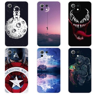 เคส เสี่ยวมี่ Xiaomi Mi 11 Lite Ne Mi11 Pro Case การ์ตูน Captain America เคสซิลิโคน Soft TPU โทรศัพท์มือถือ Back เคส