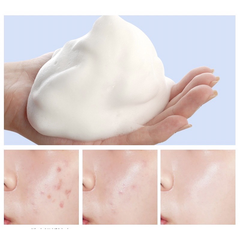 กรดอะมิโน เจลล้างหน้าโฟมล้างหน้า โฟมน้ำนมทำความสะอาดใบหน้า ลดปัญหาสิว โฟมล้างหน้าสิว คลีนซิ่ง ไม่มีแอลกอฮอล ไม่ตึงหลังกา - รูปที่ 6