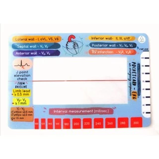 การ์ด ekg card คลื่นไฟฟ้าหัวใจ A Little Card of Ezy EKG ครอบครัวตัวคลื่น หนังสือ plearn ecg electrocardiography book
