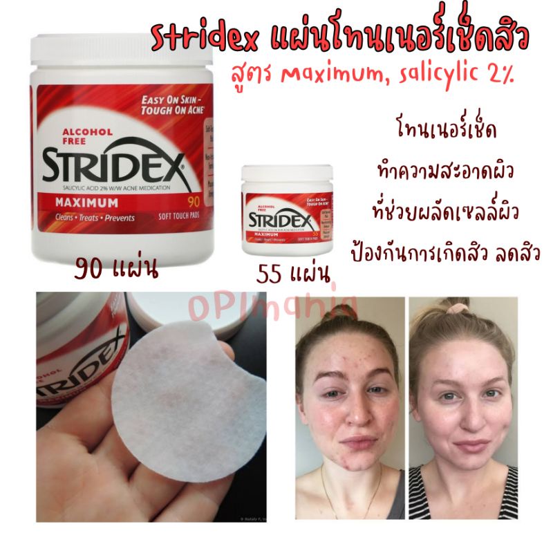 🇺🇲 Stridex สีแดง/สีฟ้า แผ่นเช็ดลดสิว สำหรับใบหน้าและตัว