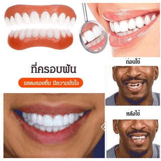 ครอบฟันขาวแบบถอดได้ ที่ครอบฟันให้ฟันขาว Snapon Smile