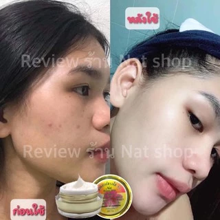 ครีมเอสวัน S1 ซุปเปอร์ขาวใส ผิวขาวใสขึ้นจริง ปลอดภัยไร้สารปรอท ขนาด 15 กรัม