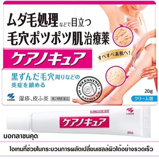 Kobayashi Keanocure 20g.  ครีมรักษาขาไม่เรียบ ขนคุด เม็ดจุดดำๆ ผดผื่น รักษาผิวทีขาให้เรียบเนียน