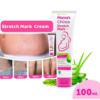 [Exp.17/11/24 ] Stretch Mark Cream ครีมลดรอยแตกลาย ครีมทาท้องลาย ท้องลาย ขาแตกลาย