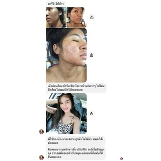 [เก็บโค้ดส่งฟรี+พร้อมส่ง]Hayeong ฮายอง ของแท้จากโรงงาน⭐ 하영สกัดจากโสมเกาหลี หน้าใส แก้ฝ้า หน้าคล้ำ 🇰🇷 ริ้วรอย จุดด่างดำ
