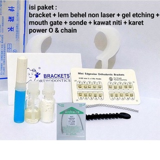 paket lengkap behel permanen + lem behel anti gagal pemasangan sendiri