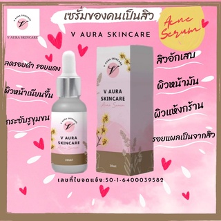 V AURA SKINCAREเซรั่มสำหรับคนเป็นสิว 📩ส่งฟรีทุกออเดอร์❤️