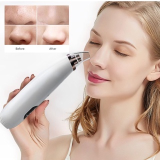 Enchen EB-1001 Blackhead Remover เครื่องดูดสิวเสี้ยน  ที่ดูดสิวเสี้ยน สิวข้างจมูก ไม่เจ็บไม่ทำร้ายผิวหนัง (245458)