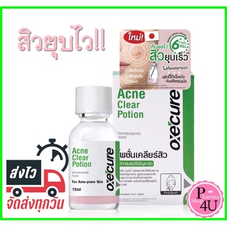 OXECURE Acne Clear Potion 15ml. อ๊อกซีเคียว แอคเน่ เคลียร์ โพชั่น ลดสิว แต้มสิวอักเสบ แต้มสิวยุบ6ชม. Oxe Cure