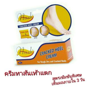 ครีมทาส้นเท้าแตก Nash cracked heel cream