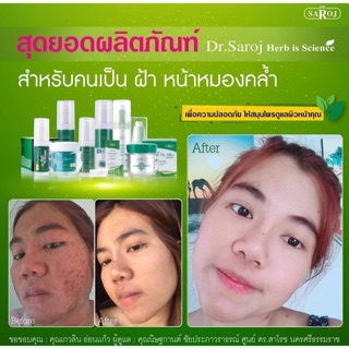 &gt;พร้อมส่ง&lt; สุดยอดผลิตภัณฑ์ สำหรับ สิว ฝ้า กระ จุดด่างดำ หน้าหมองคล้ำ ดร.สาโรช ปรึกษาสอบถามทักแชทก่อนได้เลยนะคะ {มีเก็บเง