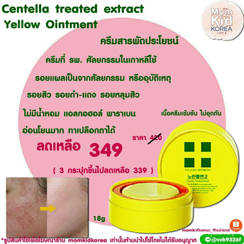 ใหม่ของแท้/พร้อมส่งYellow Ointment Centella treated Extract 18g.ครีมที่รพ.ศัลยกรรมดังๆในเกาหลีเลือกใ