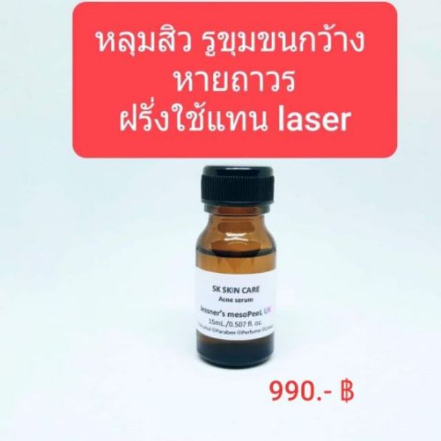 15 มล. สิวฝ้ากระ หลุมสิวลึก สิวเสี้ยน รูขุมขนกว้าง รอยดำ ปากดำ สิวหัวดำ สิวอักเสบ sk skin  jessner peel