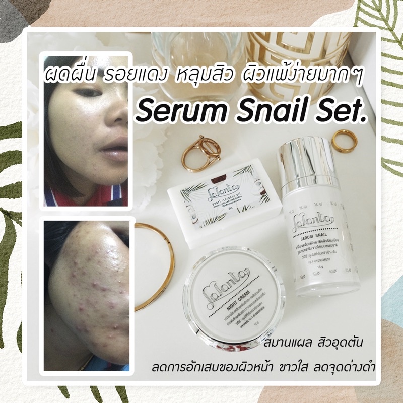 🌈ผดผื่น แพ้ง่สย ✨Lalanta Serum Snail & Night Cream Set รักษาสิวสเตียรอยด์ผดผื่นรอยแดง🔥 สินค้าอยู่ไทย