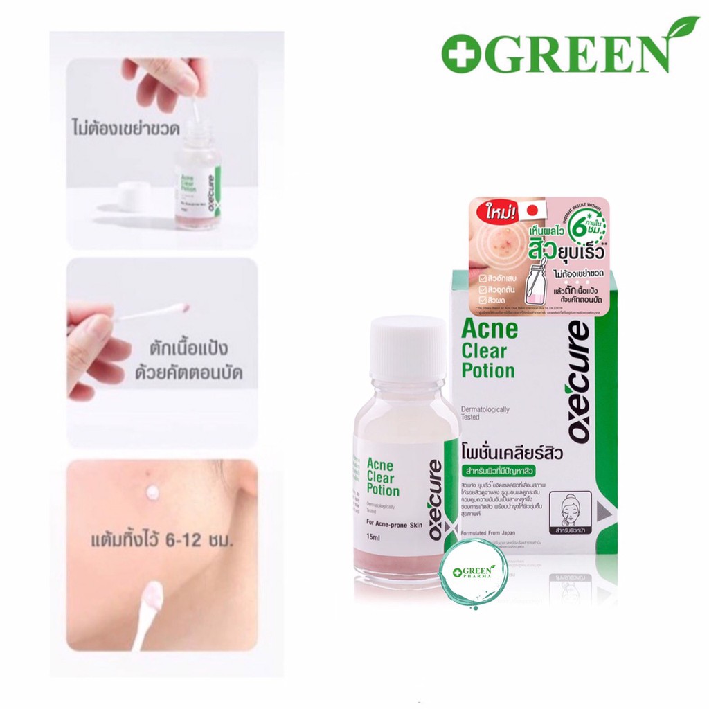 Oxecure Acne Clear Potion 15ml